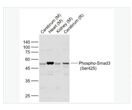 Anti-Phospho-Smad3  antibody  -磷酸化细胞信号转导分子SMAD3抗体