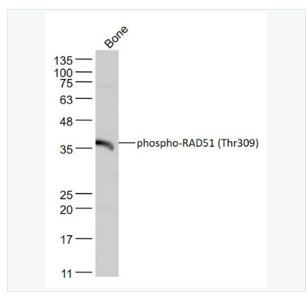 Anti-phospho-RAD51  antibody  -磷酸化Rad51抗体