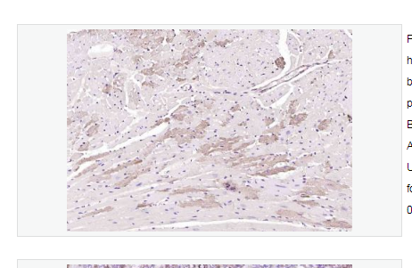 Anti-SGPL1  antibody  -磷酸鞘氨醇裂解酶1抗体