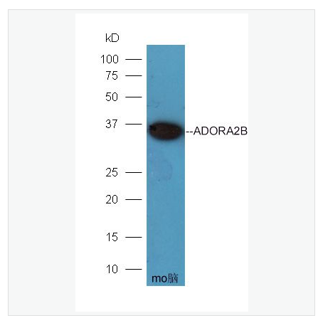 Anti-ADORA2B antibody-腺苷A2b受体/神经生长因子1受体抗体