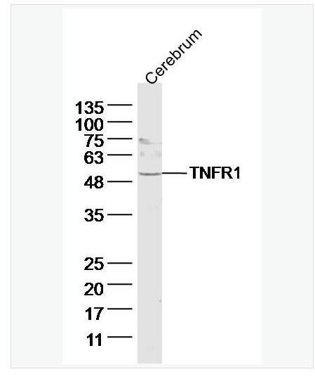 Anti-TNFR1 antibody-肿瘤坏死因子受体1抗体