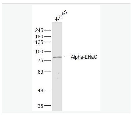 Anti-Alpha-ENaC antibody-钠通道蛋白α 抗体