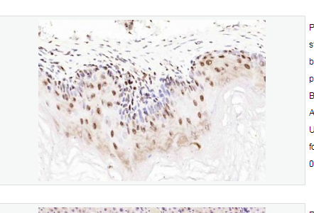 Anti-UGDH antibody-尿苷二磷酸葡萄糖脱氢酶抗体