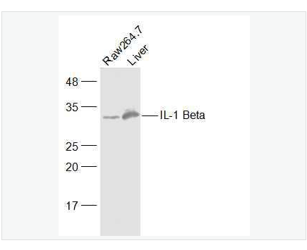 Anti-IL-1 Beta antibody-IL-白介素1β抗体