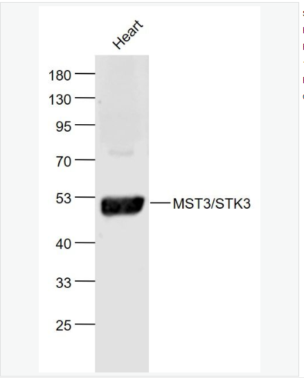 Anti-MST3/STK3 antibody-丝氨酸/苏氨酸蛋白激酶3抗体