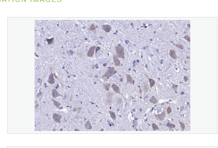 Anti-Neurotrophin 3 antibody-神经营养因子3抗体