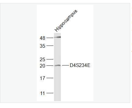 Anti-D4S234E antibody-NEEP21蛋白抗体