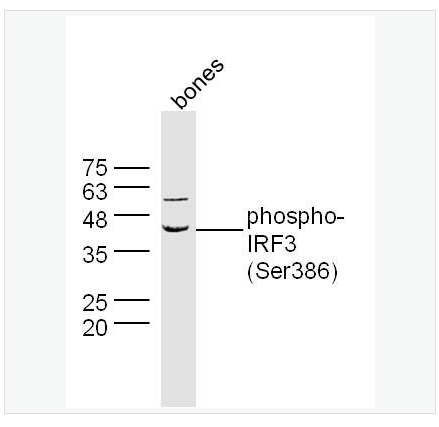 Anti-phospho-IRF3 antibody-磷酸化干扰素调节因子3抗体