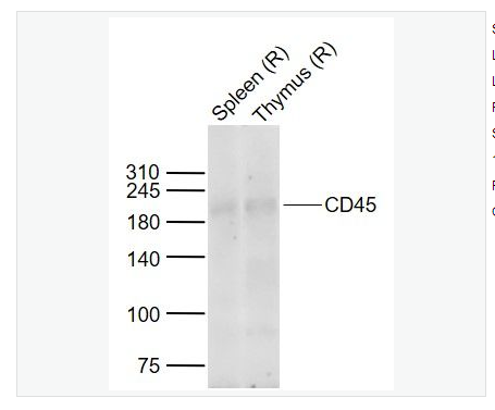 Anti-CD45 antibody-白细胞共同抗原抗体