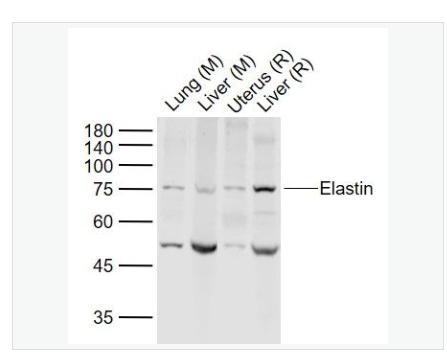 Anti-Elastin antibody-弹性蛋白抗体