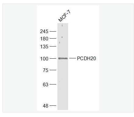 Anti-PCDH20 antibody-原钙粘附蛋白20抗体