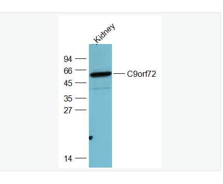 Anti-C9orf72 antibody-9号染色体开放阅读框72抗体