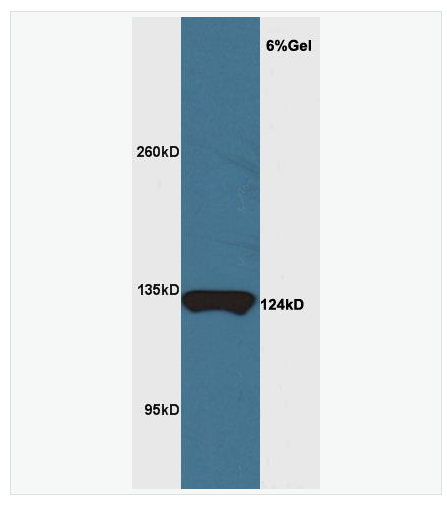 Anti-MRF/C11orf9 antibody-髓鞘基因调控因子抗体