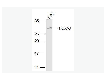 Anti-HOXA6 antibody-同源盒基因HOXA6蛋白抗体