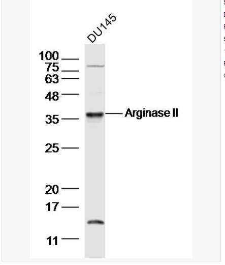 Anti-Arginase IIantibody-精氨酸酶2抗体