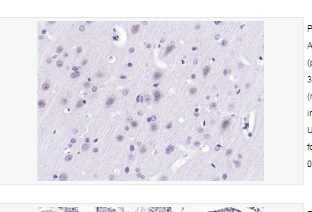 Anti-Gemin 2  antibody-脊髓性肌萎缩症蛋白SMA抗体