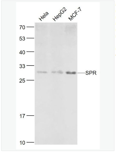 Anti-SPR  antibody-墨蝶蛉还原酶抗体