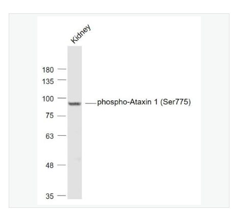 Anti-phospho-Ataxin 1 antibody-磷酸化脊髓小脑失调症蛋白1抗体