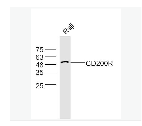 Anti-CD200R antibody-CD200受体抗体