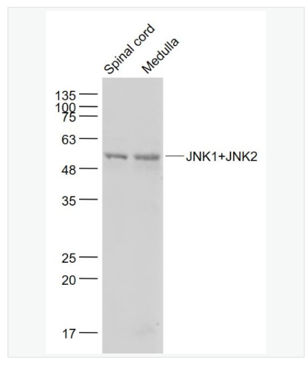 Anti-JNK1+JNK2 antibody-氨基末端激酶1/2抗体