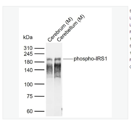 Anti-phospho-IRS1  antibody-磷酸化胰岛素受体底物1抗体