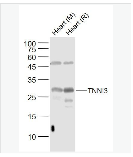 Anti-TNNI3  antibody-心肌肌钙蛋白I抗体