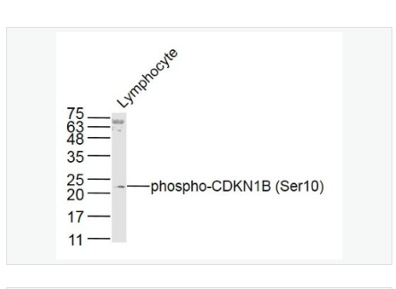 Anti-phospho-CDKN1B antibody-磷酸化P27抗体/周期素依赖激酶抑制剂