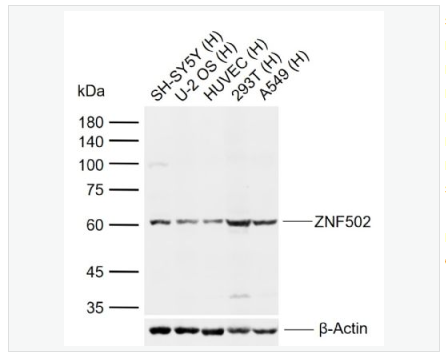 Anti-ZNF502 antibody-锌指蛋白502抗体