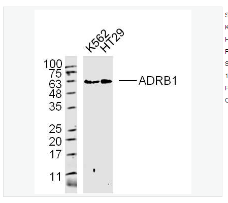 Anti-ADRB1 antibody-肾上腺素能受体β1抗体