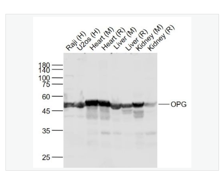 Anti-OPG  antibody-骨保护蛋白/护骨素抗体