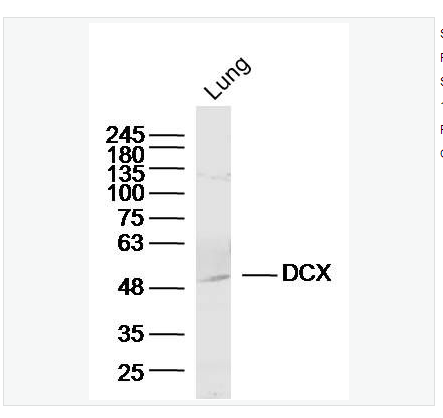 Anti-DCX/Doublecortin antibody-双皮质素抗体