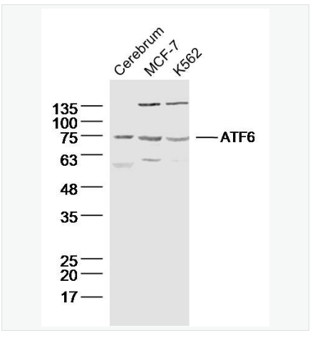 Anti-ATF6  antibody-活化转录因子6抗体