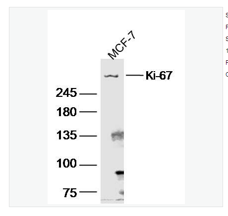 Anti-Ki-67  antibody-Ki67蛋白抗体