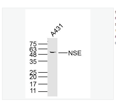 Anti-NSE antibody-神经元特异性烯醇化酶单克隆抗体