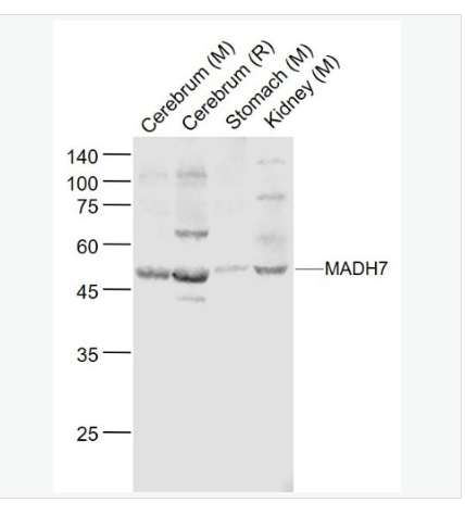Anti-SMAD7 antibody-Smad7抗体