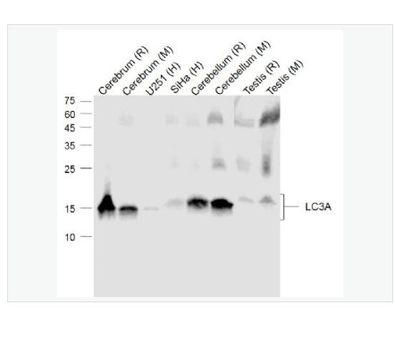 Anti-LC3A  antibody-自噬微管相关蛋白轻链3单克隆抗体
