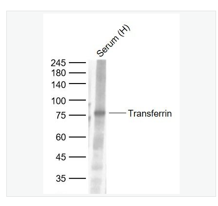 Anti-Transferrin antibody-转铁蛋白（内参）单克隆抗体