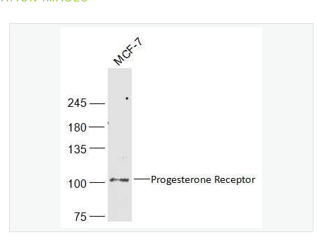 Anti-Progesterone Receptor antibody-孕激素受体抗体