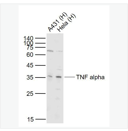 Anti-TNF alpha antibody-人肿瘤坏死因子