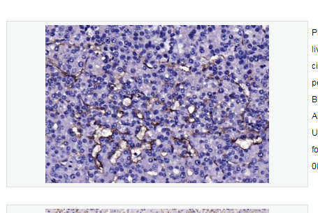 Anti-CD105 antibody-CD105抗体