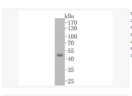 Anti-Aurora A  antibody-有丝分裂激酶A与重组兔单克隆抗体