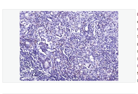 Anti-phospho-EGFR  antibody-磷酸化表皮生长因子受体重组兔单克隆抗体