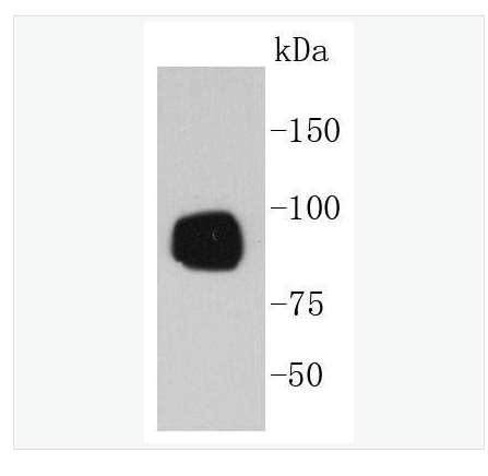 Anti-Phospho-RPS6KA1  antibody-磷酸化丝氨酸/苏氨酸激酶p90RSK蛋白重组兔单克隆抗体