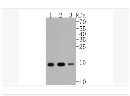 Anti-Histone H3 antibody-乙酰化组蛋白3（K14）重组兔单克隆抗体