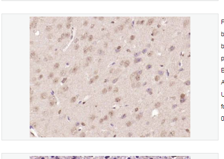 Anti-Nur77 antibody-孤儿核受体蛋白Nur77抗体