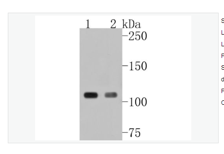 Anti-GEF H1 antibody-Rho鸟苷酸交换因子2重组兔单克隆抗体