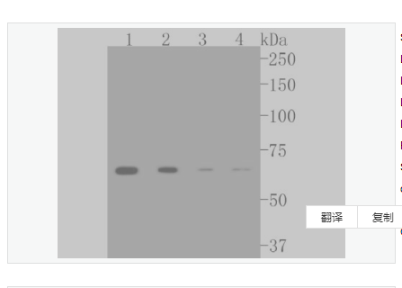 Anti-CPT2 antibody-肉毒碱棕榈酰基转移酶2重组兔单克隆抗体