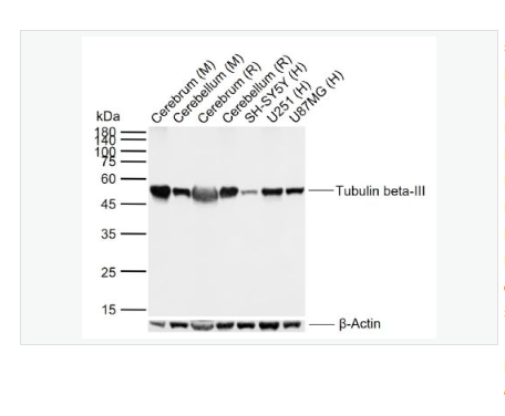 Anti-Tubulin beta-III antibody-微管蛋白β3重组兔单克隆抗体