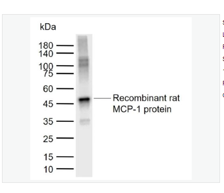 Anti-MCP1  antibody-单核细胞趋化蛋白1抗体