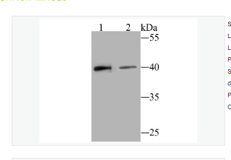 Anti-BST2 antibody-骨髓基质干细胞抗原2重组兔单克隆抗体